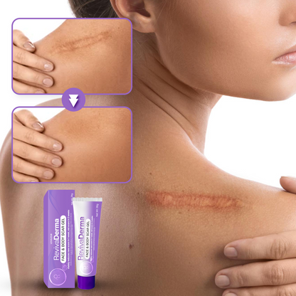 🔥LOVILDS® RevivaDerma Face & Body Scar Gel - Clinically proven to soften, flatten and fade surgical scars, acne marks, burns, keloids and trauma-related scars
