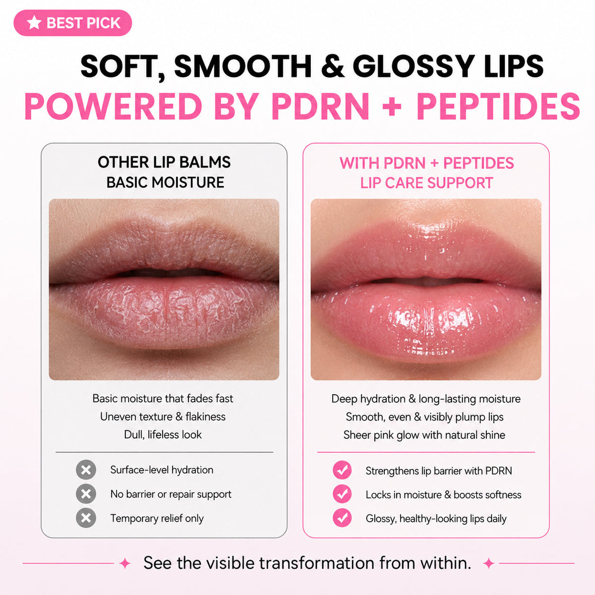 PDRN Peptide Lip Balm — Hydrating Care & Glossy Shine